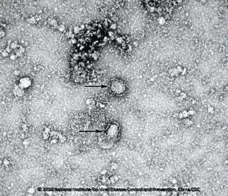 ▲新型冠狀病毒武漢株01。照片來(lái)源：國(guó)家病原微生物資源庫(kù)（中國(guó)疾病預(yù)防控制中心病毒病預(yù)防控制所）